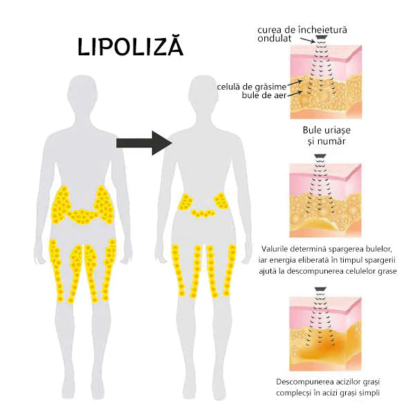 🌻J0SFIT™ Ultrazvočni program za razstrupljanje in zmanjšanje maščobe