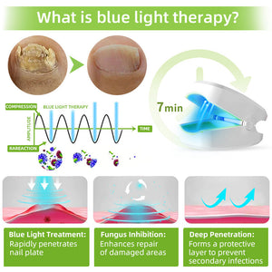 Furzero™ naprava za lasersko terapijo glivic na nohtih Max Plus