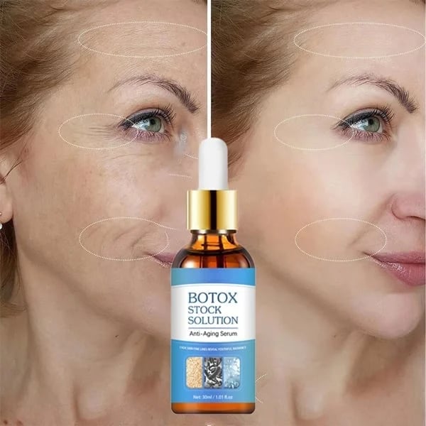 70% OFF Zadnjih sedem dni - 🔥Botox serum za obraz