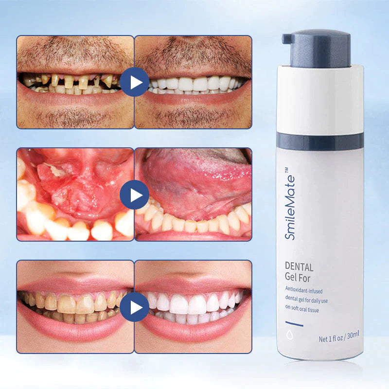 Vroča prodaja 70% Off-SmileMate™ Teeth Whitening Repair Regrowth Dental Gel