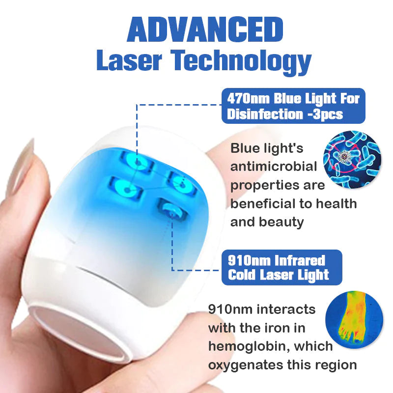 (🔥OMEJEN POPUST 70% - ZADNJI DAN)Furzero™ laserska naprava za odstranjevanje glivic na nohtih