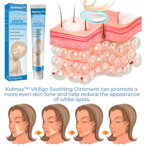 Kolmax™ Vitiligo blagodejno mazilo