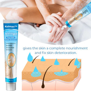 Kolmax™ Vitiligo blagodejno mazilo